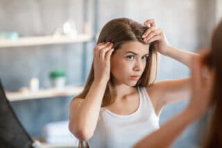 how to eliminate dandruff